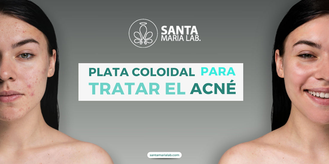 Plata Coloidal para Tratar el Acné